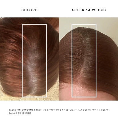 Calmvista Hair Regrowth & Therapy Cap